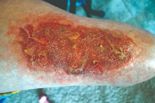 Load image into Gallery viewer, Wigley FX Infection Large