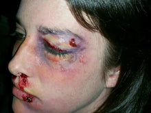 Load image into Gallery viewer, Wigley FX Swollen Eye