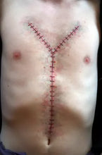 Load image into Gallery viewer, Wigley FX Y Incision