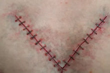 Load image into Gallery viewer, Wigley FX Y Incision