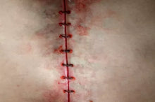 Load image into Gallery viewer, Wigley FX Y Incision