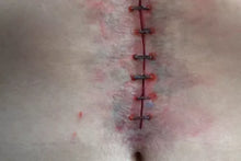 Load image into Gallery viewer, Wigley FX Y Incision